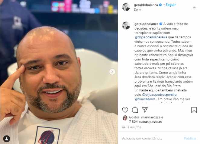 Geraldo Luís realizou um transplante capilar em São José do Rio Preto (Foto: Reprodução)