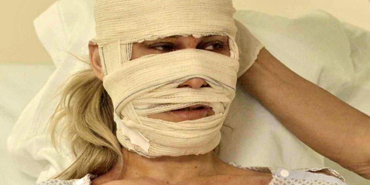 Jéssica (Karen Junqueira) sofre acidente terrível e fica desfigurada no final de Haja Coração (Foto: Reprodução/TV Globo)
