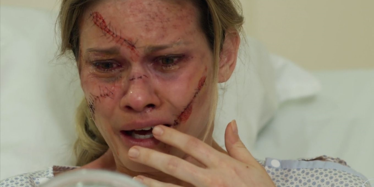 Jéssica (Karen Junqueira) se desespera ao ver o rosto deformado em Haja Coração (Foto: Reprodução/TV Globo)