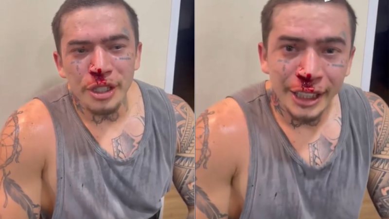 Whindersson Nunes surge com o rosto coberto de sangue após luta (Foto: Instagram)